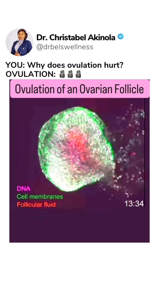 Instagram post by @drbelswellness for Mira Fertility. Caption reads: Do you experience pain during ovulation? 🥹 Now....