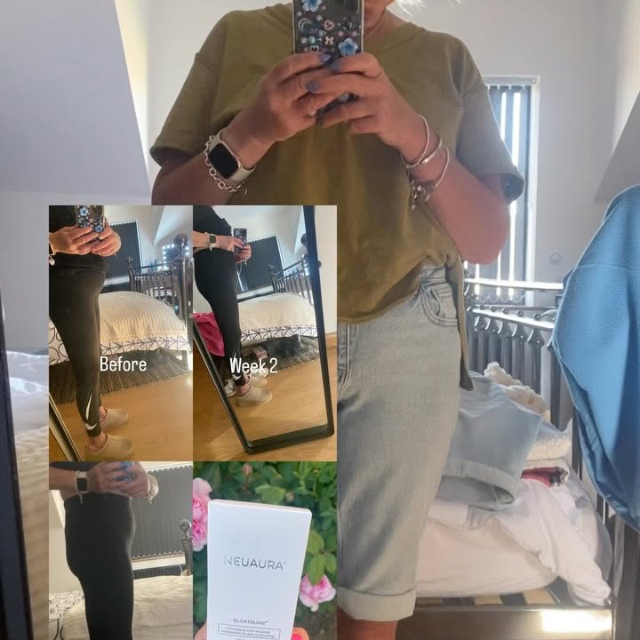 Instagram post by @dunroaminagain for Neuaura. Caption reads: [...] 5 of taking Bloat Burn supplements by....