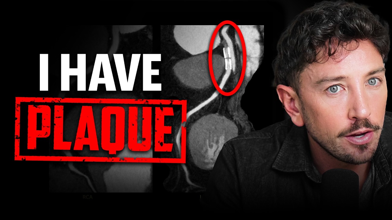 YouTube post by @TheProofWithSimonHill for Bragg. Caption reads: Do I Have Heart Disease? My Heart Scan Results |....