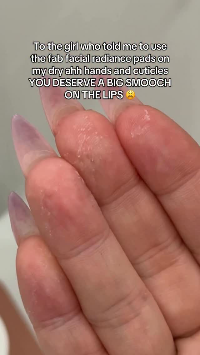 Instagram post by @hydrationceo for First Aid Beauty. Caption reads: Literally a 2 day difference my GAWD 😩😩😩 

....