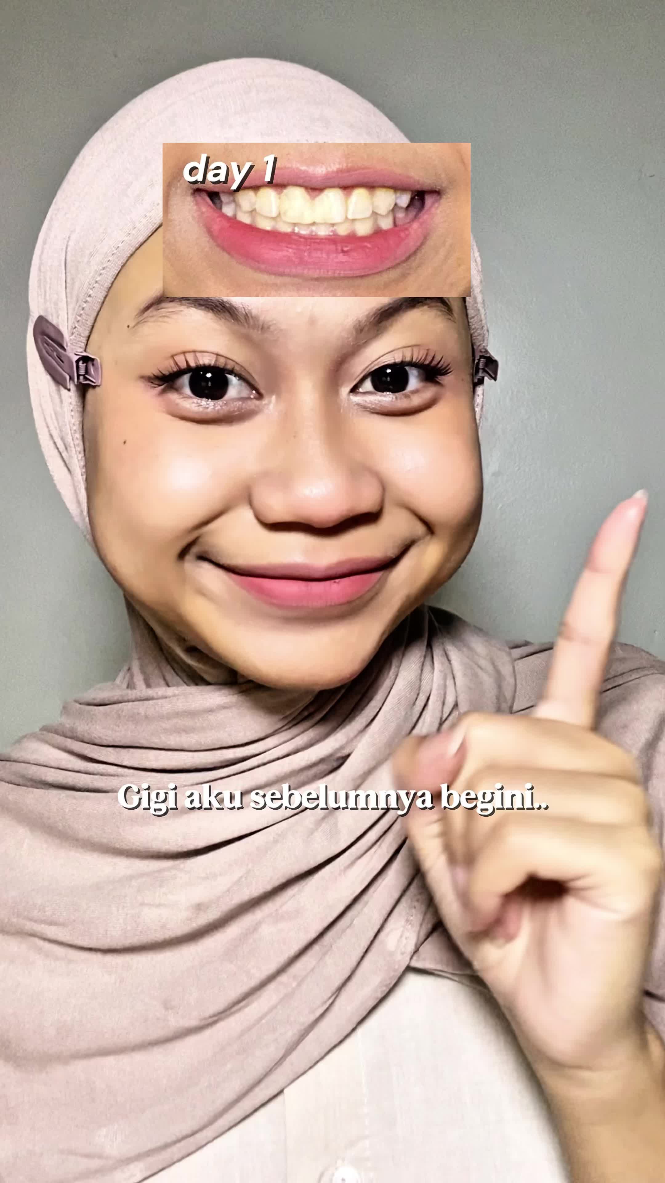 TikTok post by @kiawarchive for Metoo Beauty. Caption reads: @Metoo Beauty Solusi biar gigi ga kuning 🤍 #MW3....