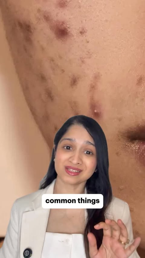 Instagram post by @dr.manasi.skin for Deconstruct. Caption reads: [...] pigmentation concerns matters like -....