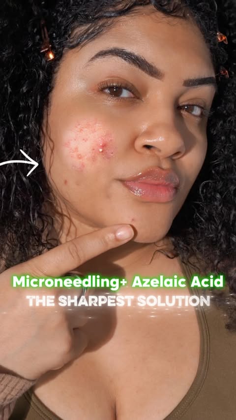 Instagram post by @lishaeubanks for Mary&May. Caption reads: 300,000 micro-spicules in a spot cream?! 👀💚 Meet....