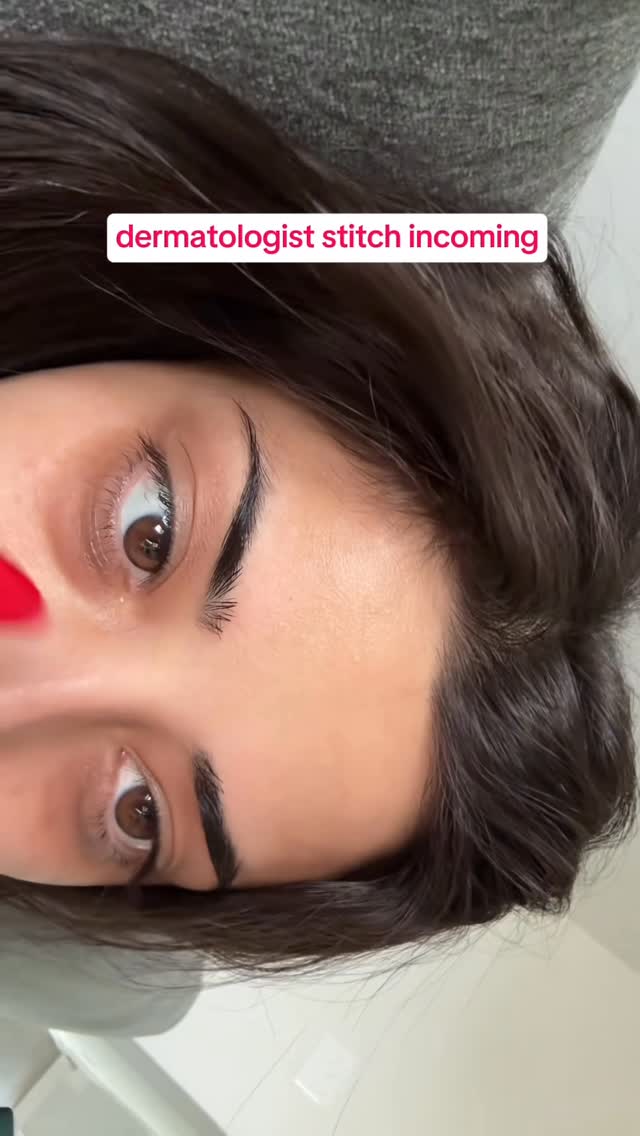 Instagram post by @dermatologysurgeon for RoC Skincare. Caption reads: #roc_partner You guys know I had a laser treatment....