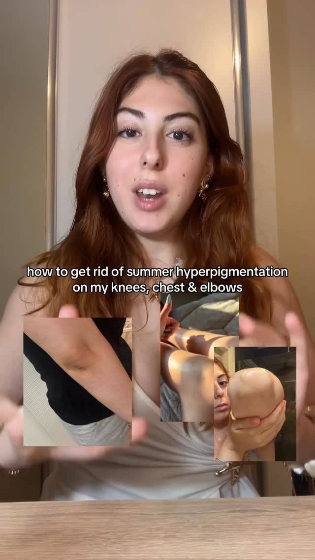 Instagram post by @maya.videodiary for APRILSKIN. Caption reads: How to get rid of summer hyperpigmentation ....