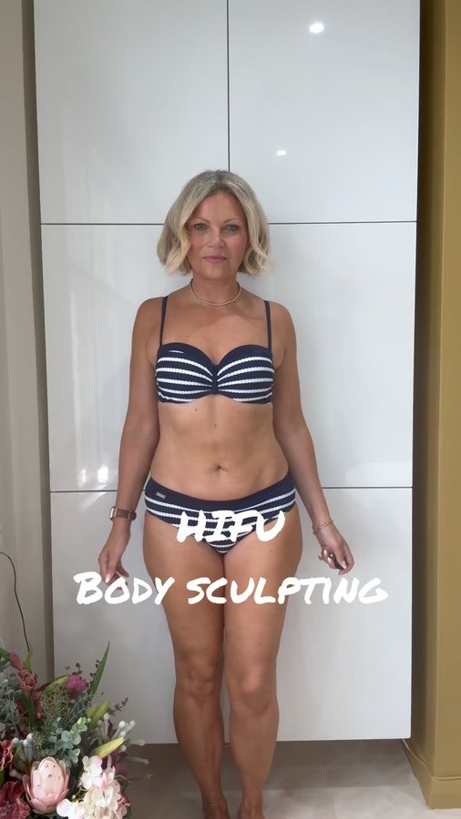 Instagram post by an influencer for Vanity Lab London. Caption reads: [...] to ✨HIFU with Julie at @vanitylablondon ✨....