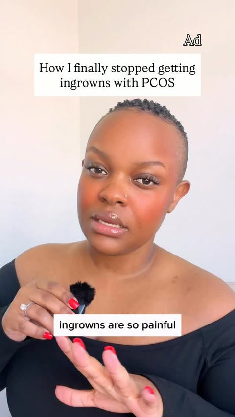 Instagram post by @caveofbeauty for Milan Laser Hair Removal. Caption reads: Do you get ingrown hairs even when you’re not....