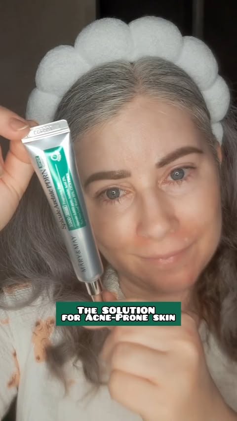Instagram post by @ana.bute.3 for Mary&May. Caption reads: Microneeding + Azelaic Acid The SHARPEST solution....