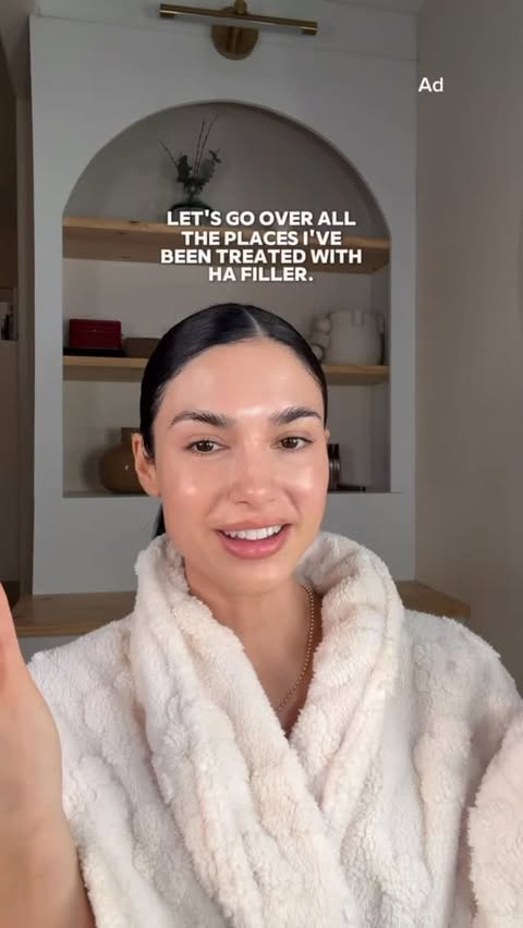 Instagram post by @np.miranda for Allergan Aesthetics. Caption reads: AD Not all types of fillers are the same.....