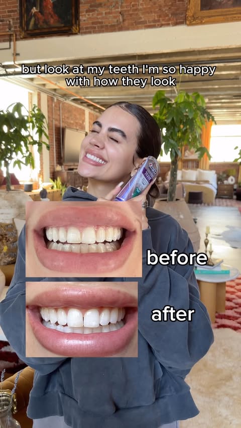 Instagram post by @madiwebb for Amazon Influencer Program. Caption reads: [...] Stain Remover Toothpaste #ad....