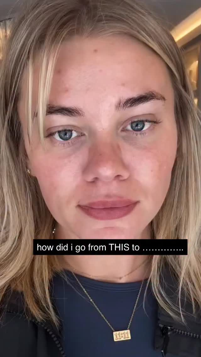 Instagram post by @katehayesmakeup for Dermatica. Caption reads: Here is my Skin Update and latest must haves with....