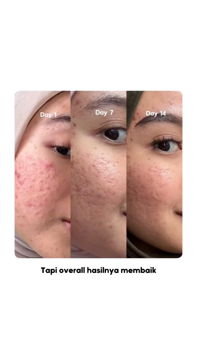 Instagram post by @ratughania for Scarlett Whitening. Caption reads: Wish me luckkk!! Semoga semakin hari semakin....