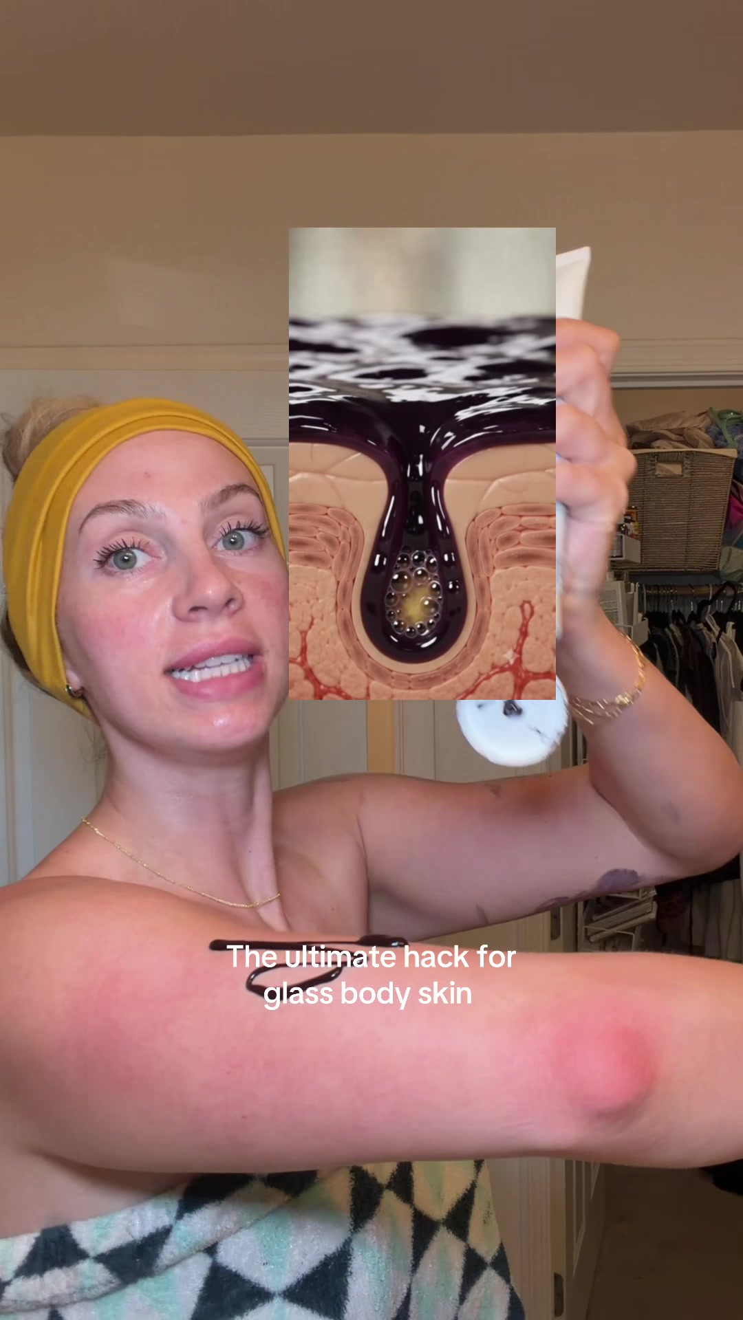 TikTok post by @neaveem for Abi Amé. Caption reads: [...] textured skin, keratosis pilaris 🔥 @ABI AMÉ....