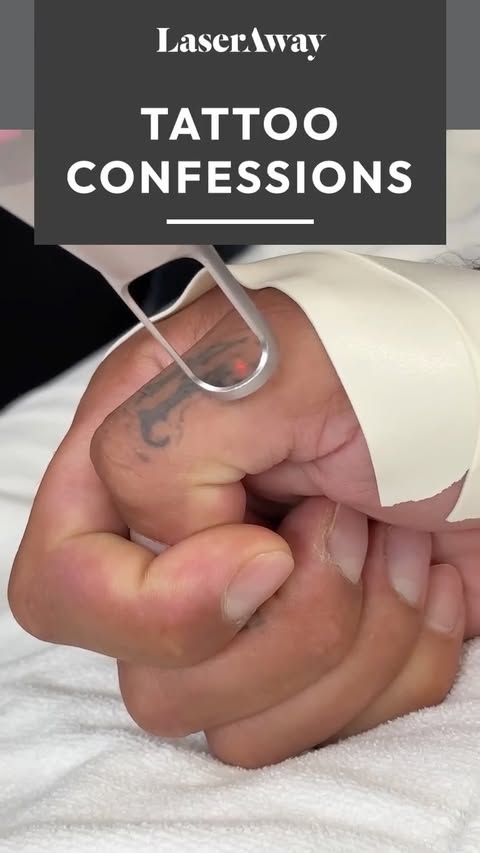 Instagram post by @yo_daddy_brandon for LaserAway. Caption reads: [...] we've got you. With Laser Tattoo Removal by....