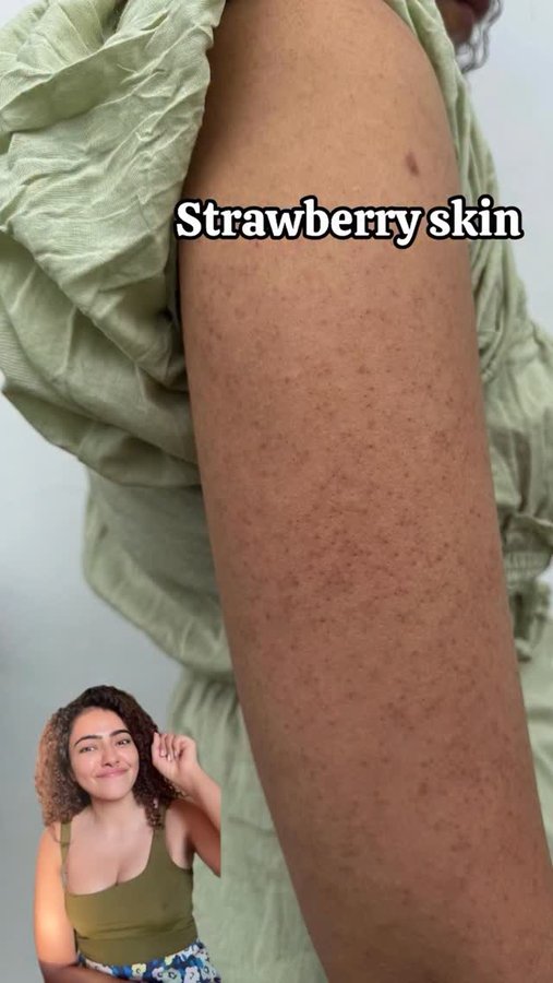 Instagram post by @timsyskinopedia for Foxtale. Caption reads: My new shower obsession: exfoliate, glow,....