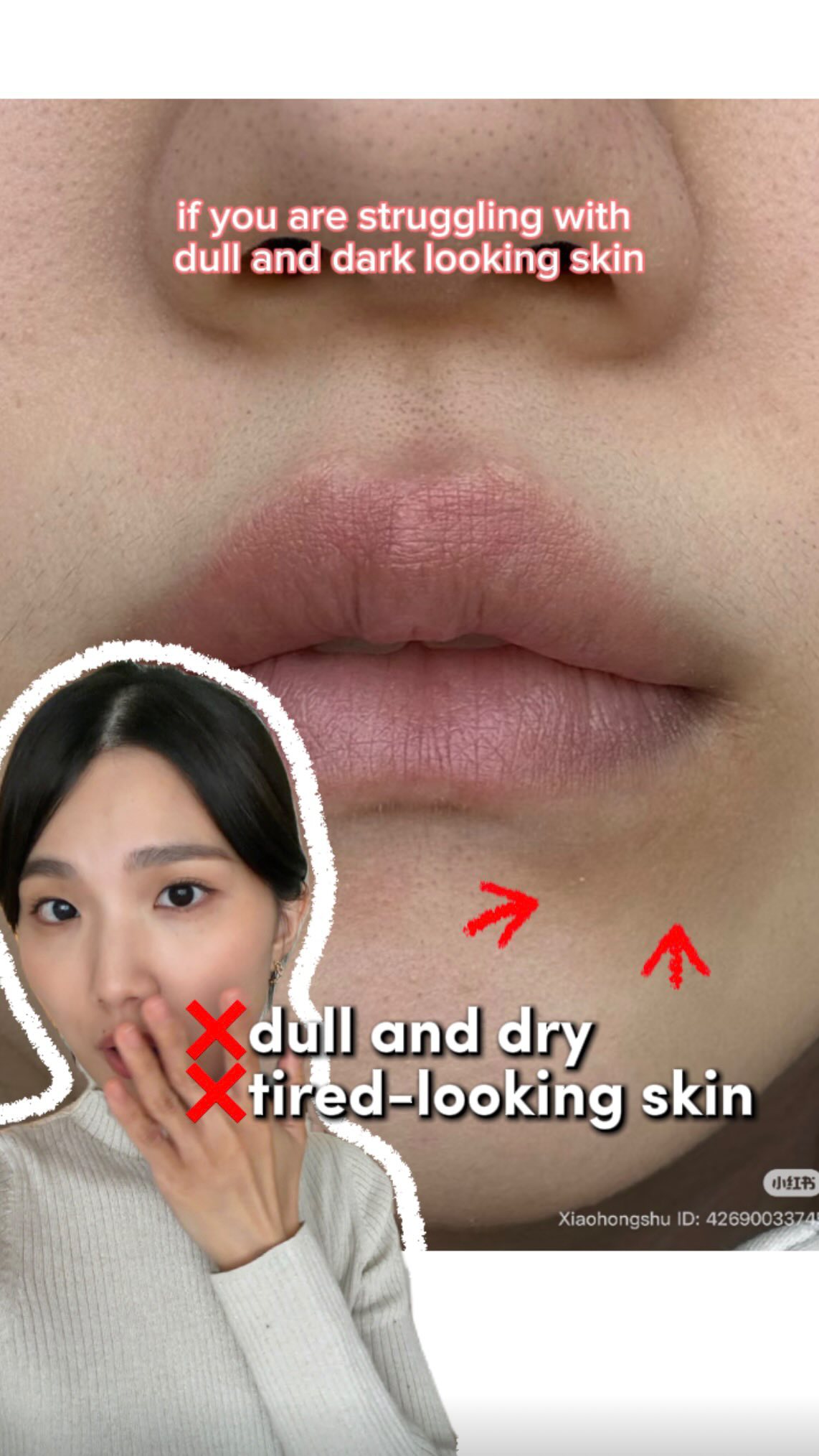 Instagram post by @hithisisdaisy for FRANKLY. Caption reads: [...] dull to brighter and bouncy skin with....