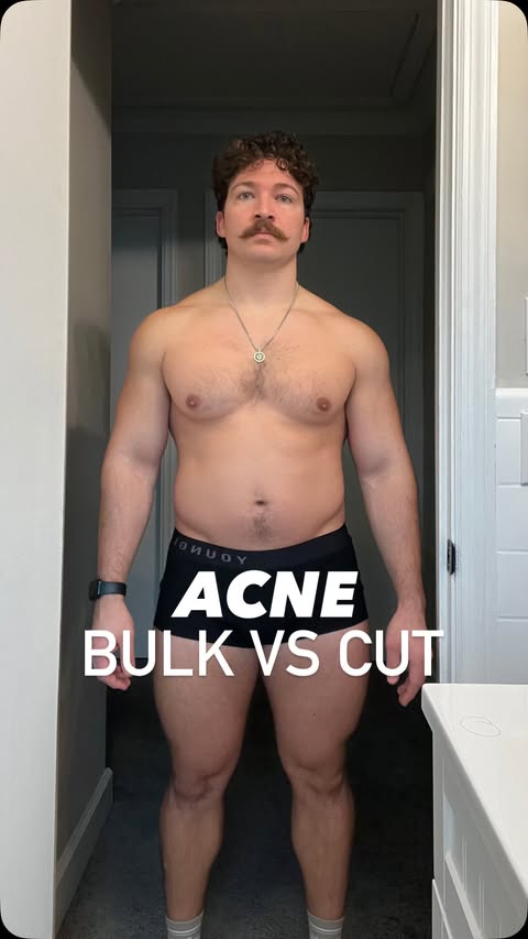 Instagram post by @quinton_pulliam for YoungLA. Caption reads: What’s your experience with acne on the cut or....