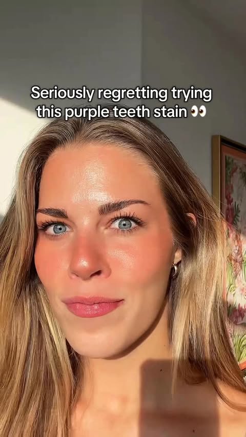 Instagram post by @allikaed for Hismile. Caption reads: Was it worth it?🫣😁 #ad #sponsored....