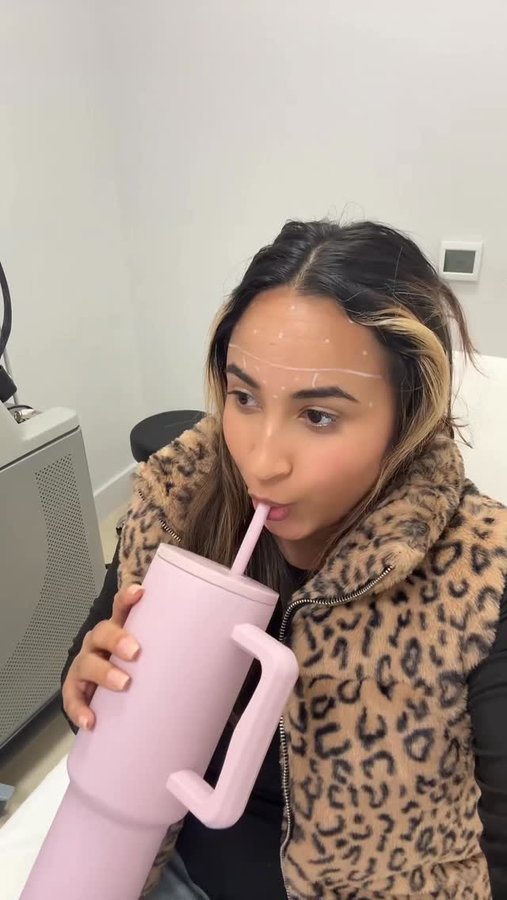 Instagram post by @morganbaiiley for LaserAway. Caption reads: Botox day @laseraway 💗 #LApromotion #ad.