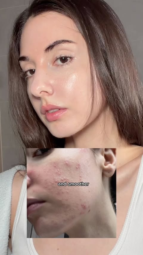 Instagram post by @rachelheheh for celimax. Caption reads: [...] #retinal #tretinoin #koreanskincare #celimax....