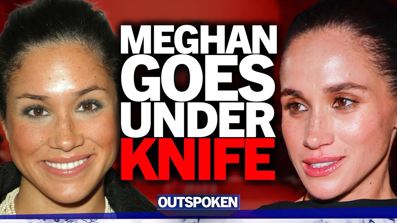 YouTube post by @danwoottonoutspoken for Surfshark. Caption reads: "Facelift, necklift, nose job & more!" Meghan....