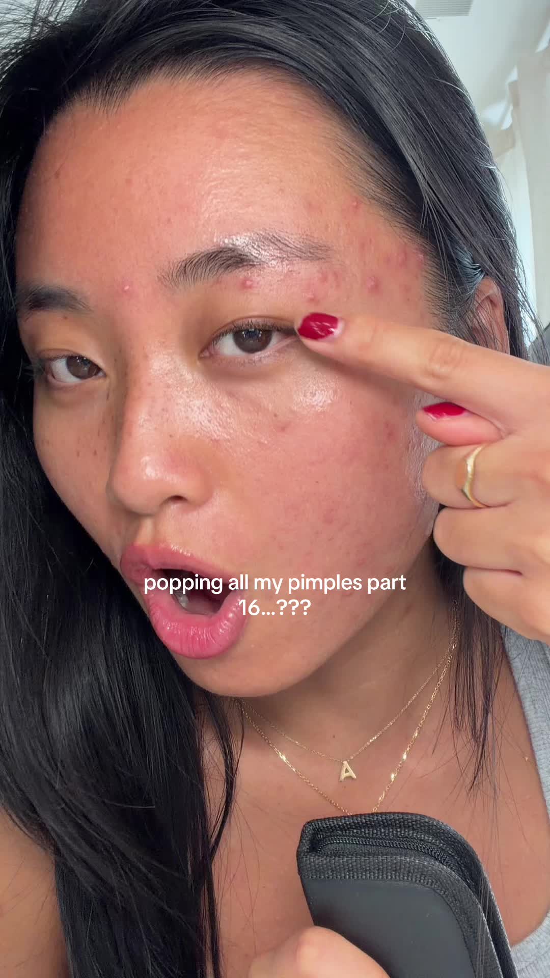 TikTok post by @_alliechen for PanOxyl. Caption reads: i cant look at my eyebrow pimples it makes me so....