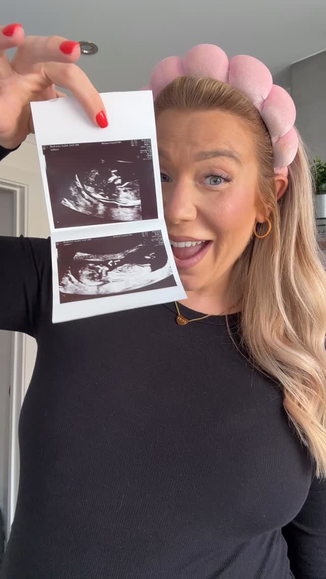 Instagram post by @scarletts_world_ for Rheal Superfoods. Caption reads: HOSPITAL BAG SNACKS - drop your must haves in the....