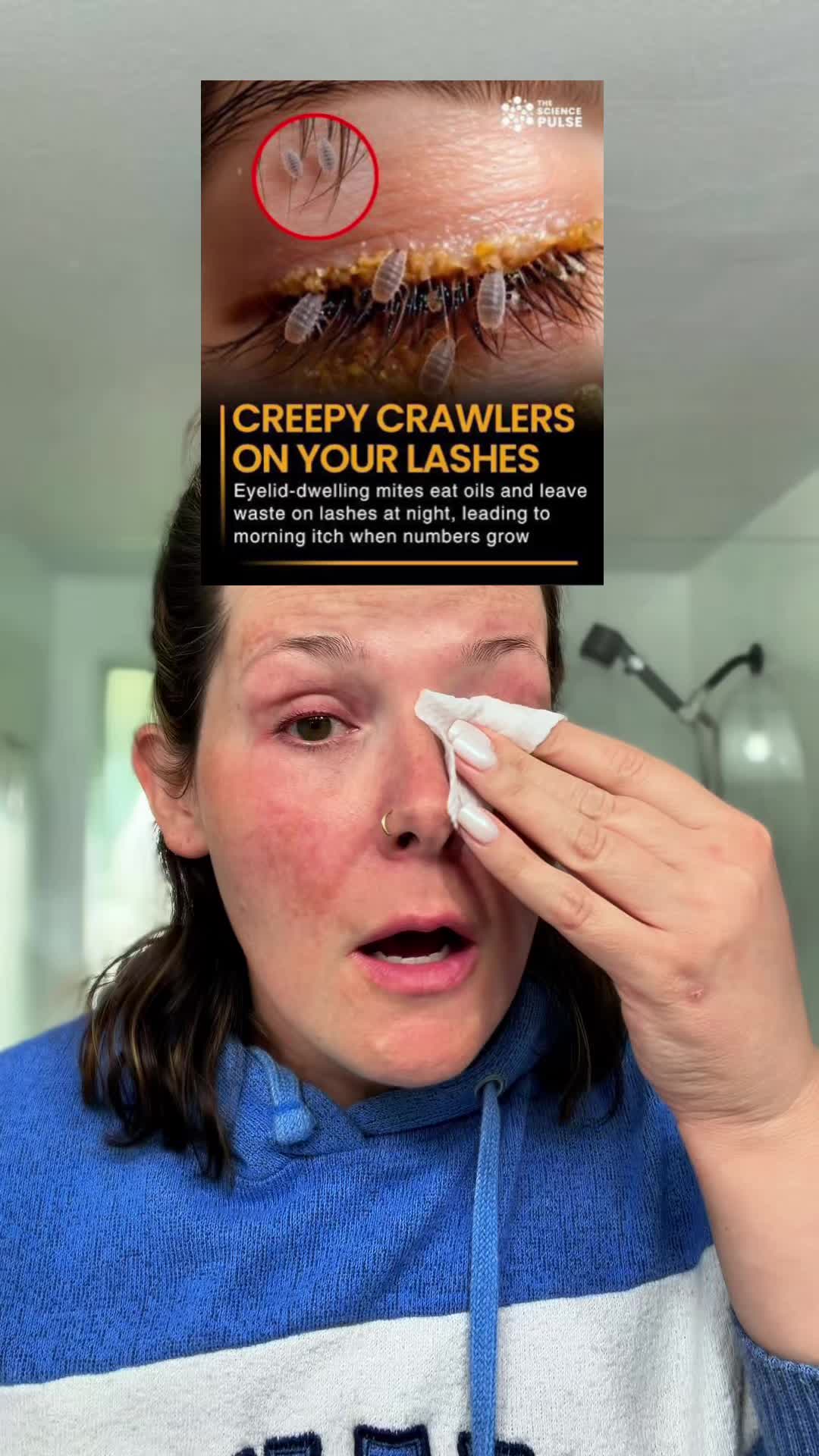TikTok post by @thetiktokshopnurse for CorneaCare. Caption reads: [...] and Demodex eyelash mites. @CorneaCare....