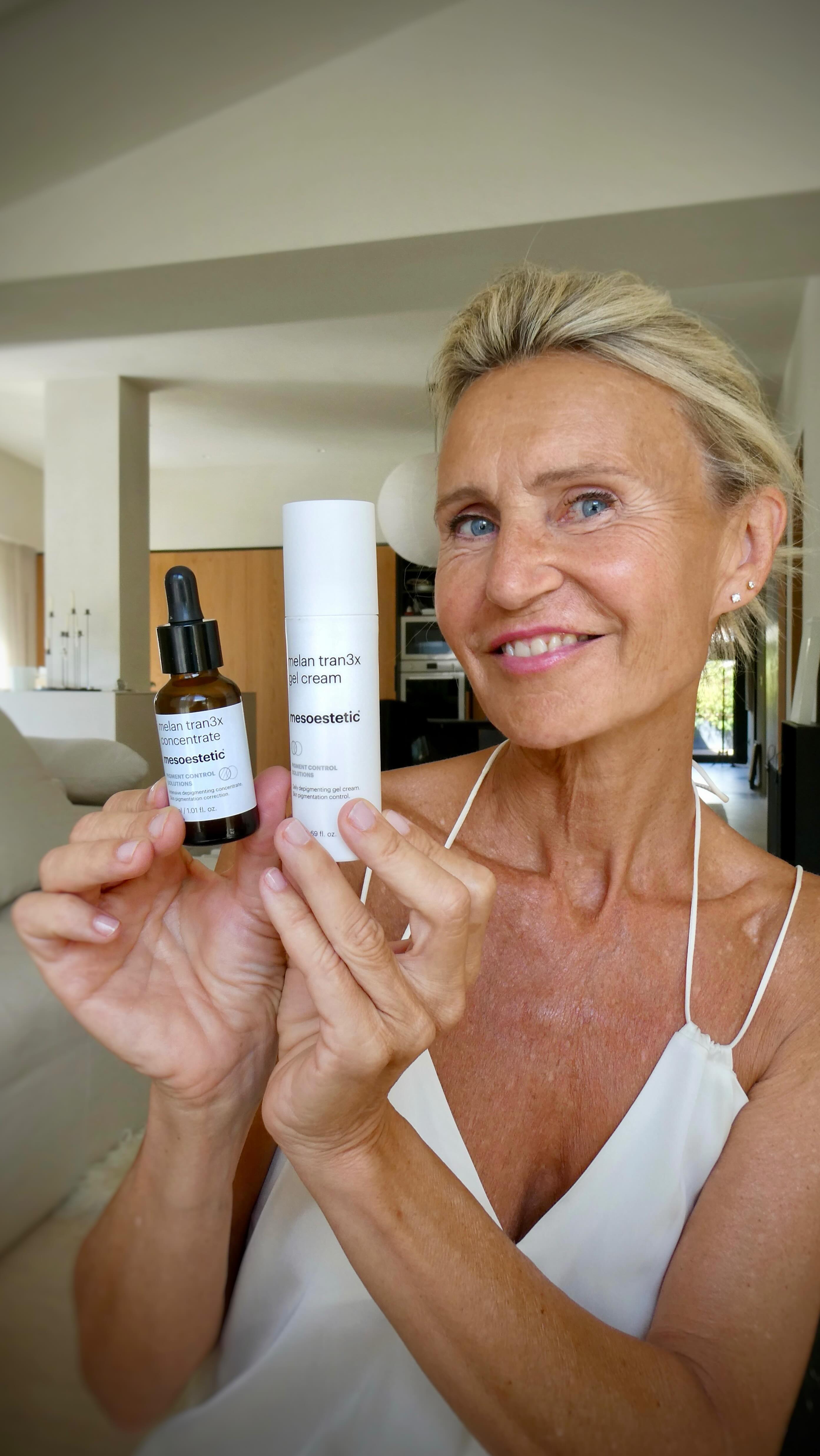 Instagram post by @patzhunter for mesoestetic. Caption reads: Después del verano , las manchas se ven más y por....