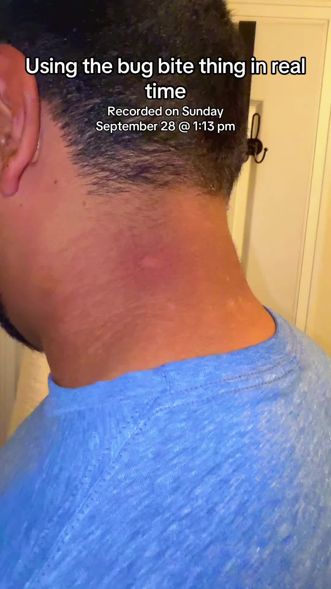 TikTok post by @completelycori for Bug Bite Thing. Caption reads: @Bug Bite Thing really does work! @Brandyn got....