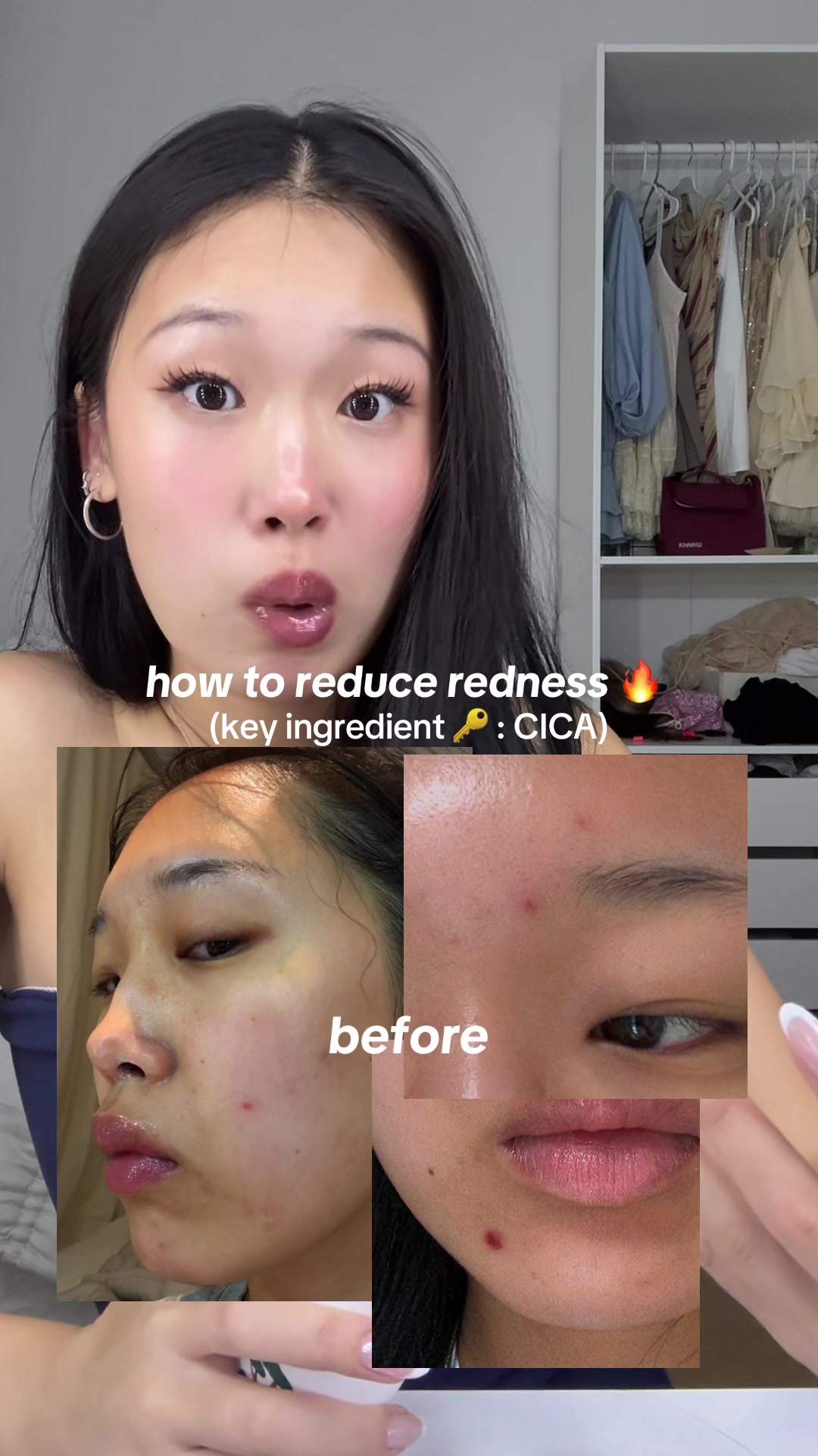 TikTok post by @via..li for Round Lab. Caption reads: [...] have redness GET THIS LINE TRUSTTTTT @ROUND....