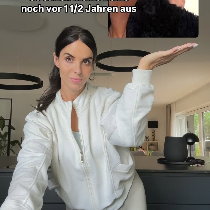 Instagram post by @janinefischerp for Shape Republic. Caption reads: Anzeige | Meine persönliche Problemzone waren....