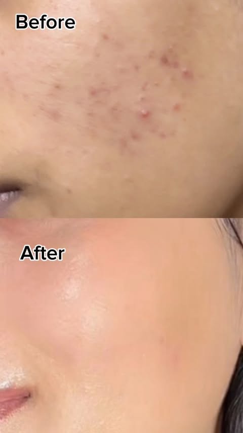 Instagram post by @_prii04 for AXIS-Y. Caption reads: A lightweight serum from Axis-y that became a....
