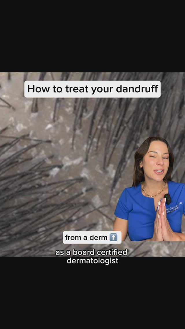 Instagram post by @dermguru for Head&Shoulders. Caption reads: FLAKY SCALP? Don’t know her, but only if you....
