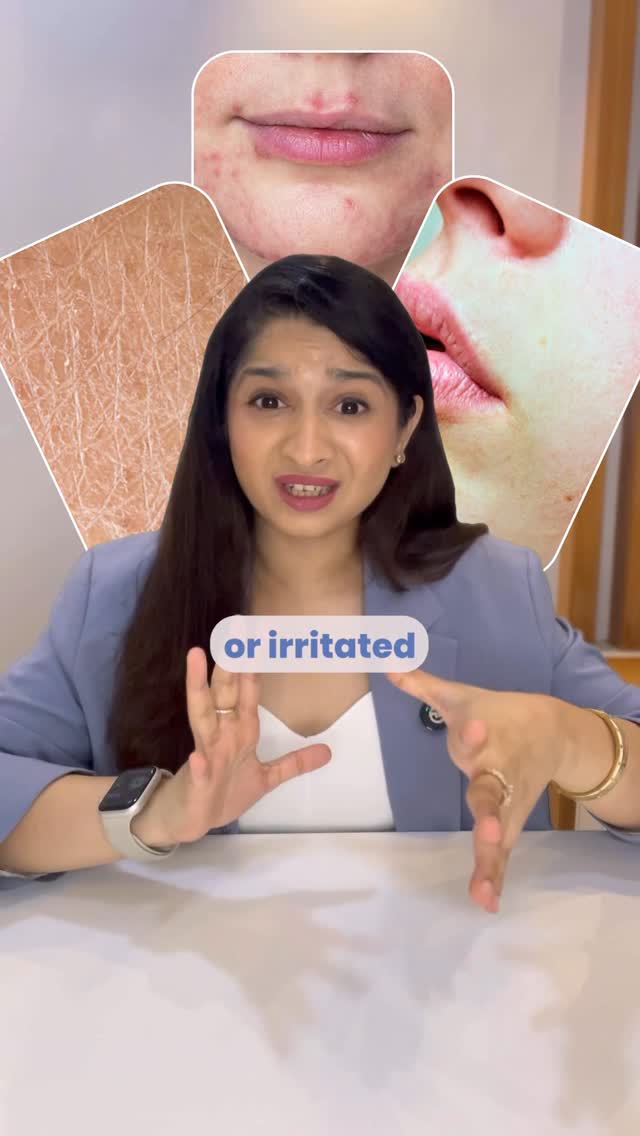 Instagram post by @dr.manasi.skin for Reequil. Caption reads: Winter is almost here, and that means dry, tight,....