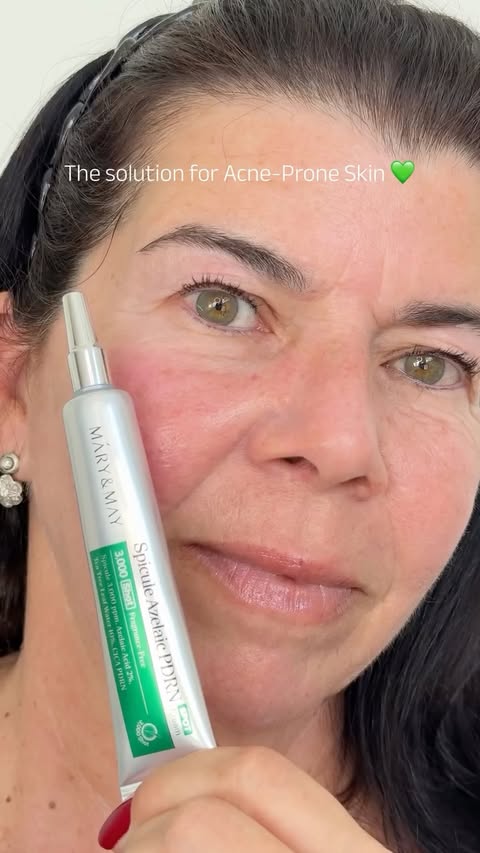 Instagram post by @mowebcat.skincare for Mary&May. Caption reads: [...] benefits of microneedling at home. The....