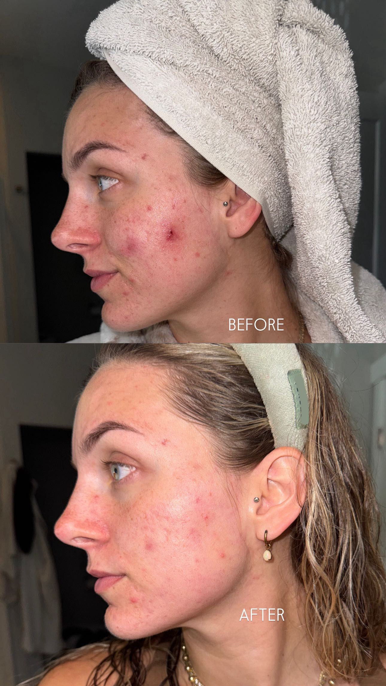 Instagram post by @aleximckinley for ZIIP Beauty. Caption reads: #ad Best bang for your buck!! Love this device....