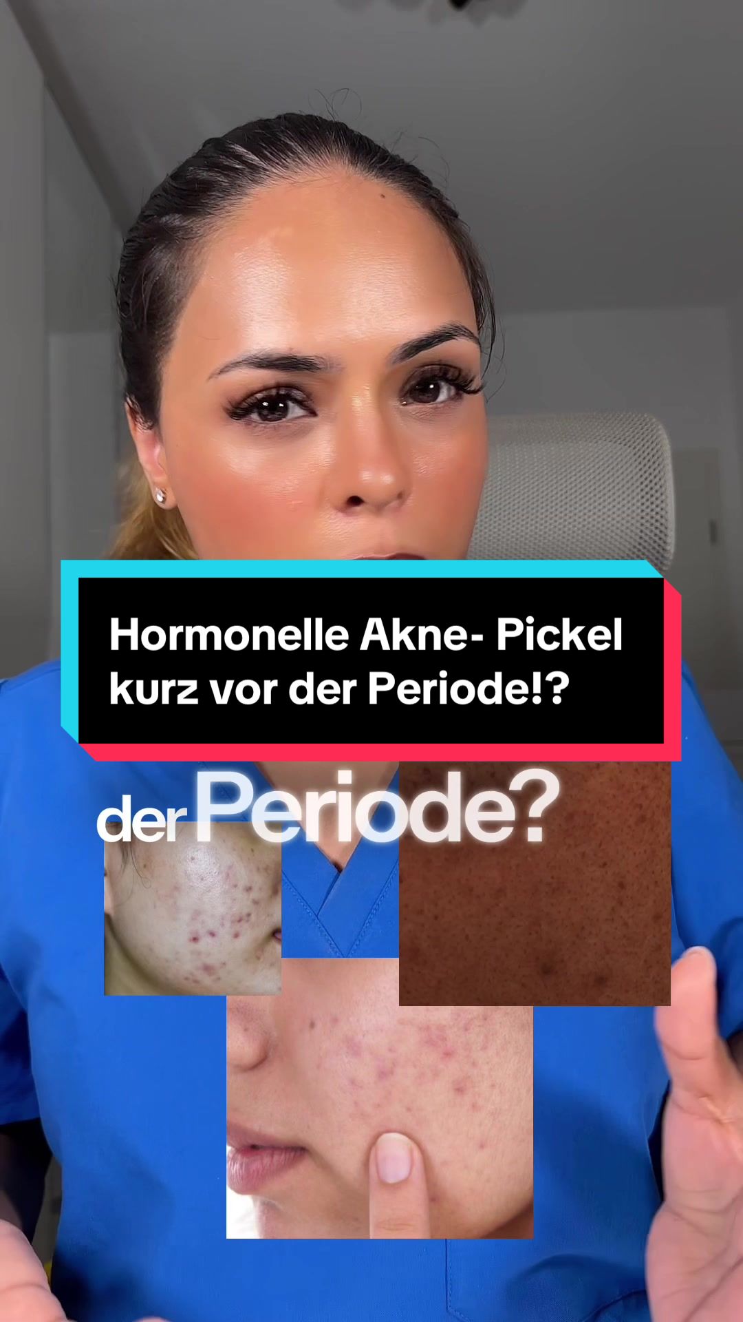 TikTok post by @medsri for La Roche-Posay. Caption reads: Anzeige | hormonelle Akne? Hier kann die Effaclar....