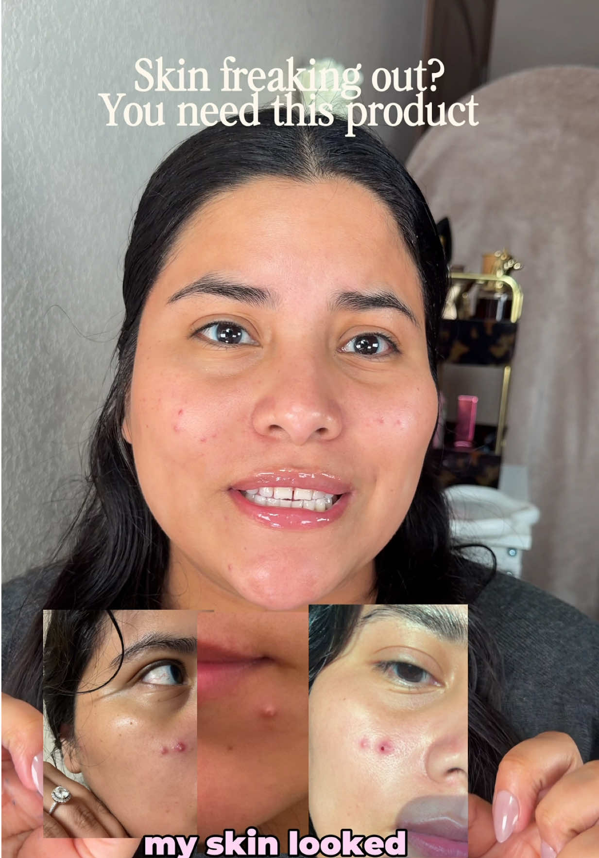 TikTok post by @simplymaryy.v for Magic Molecule. Caption reads: My skin just needed a little of @Magic Molecule....