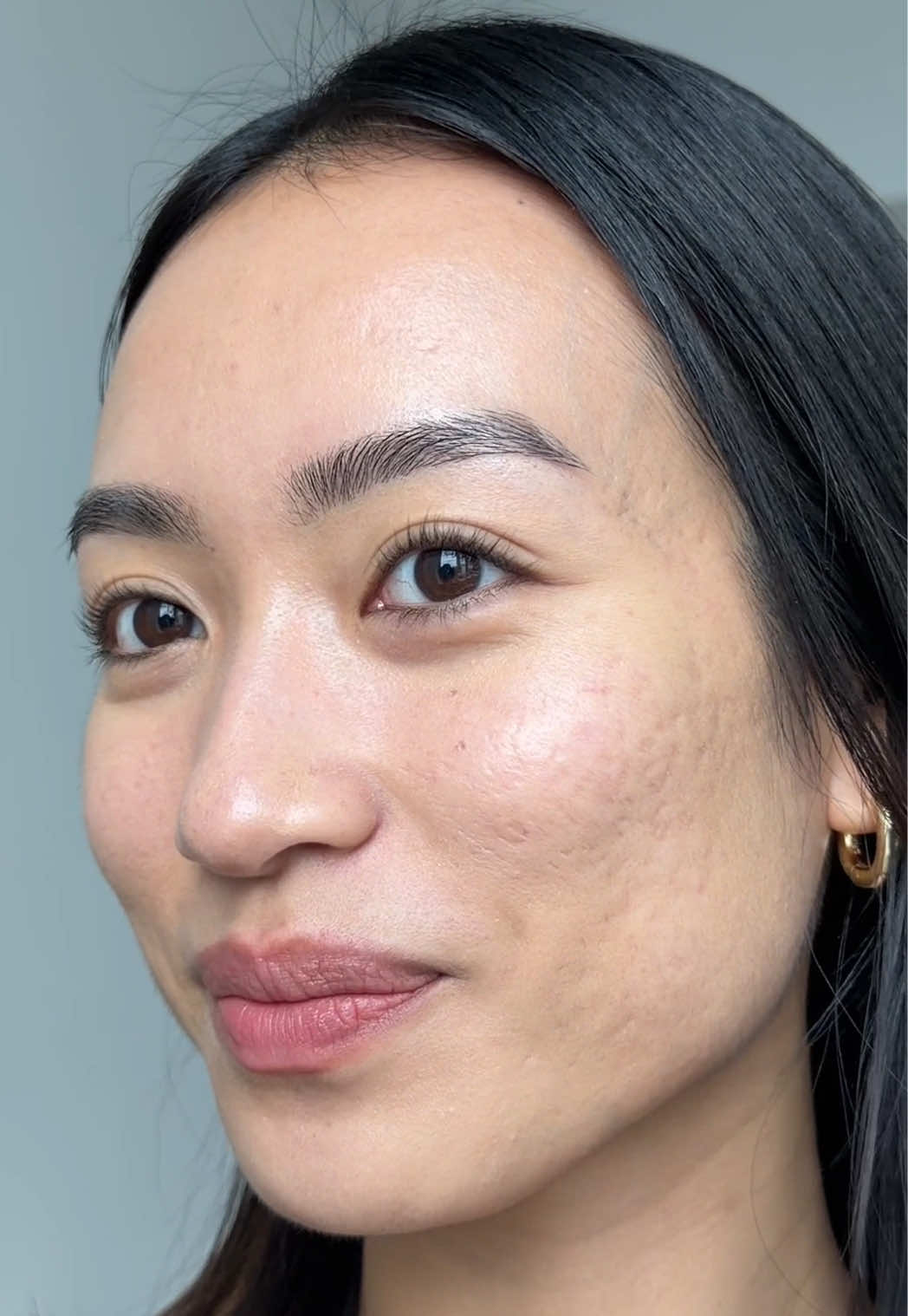 TikTok post by @its.shinyhere for bareMinerals. Caption reads: less is more with acne-prone skin & @bareMinerals....