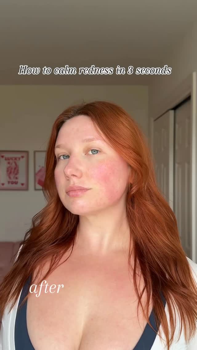 Instagram post by @b1gbimbo for dalbaglobal. Caption reads: The quick fix that rescues my skin after a....