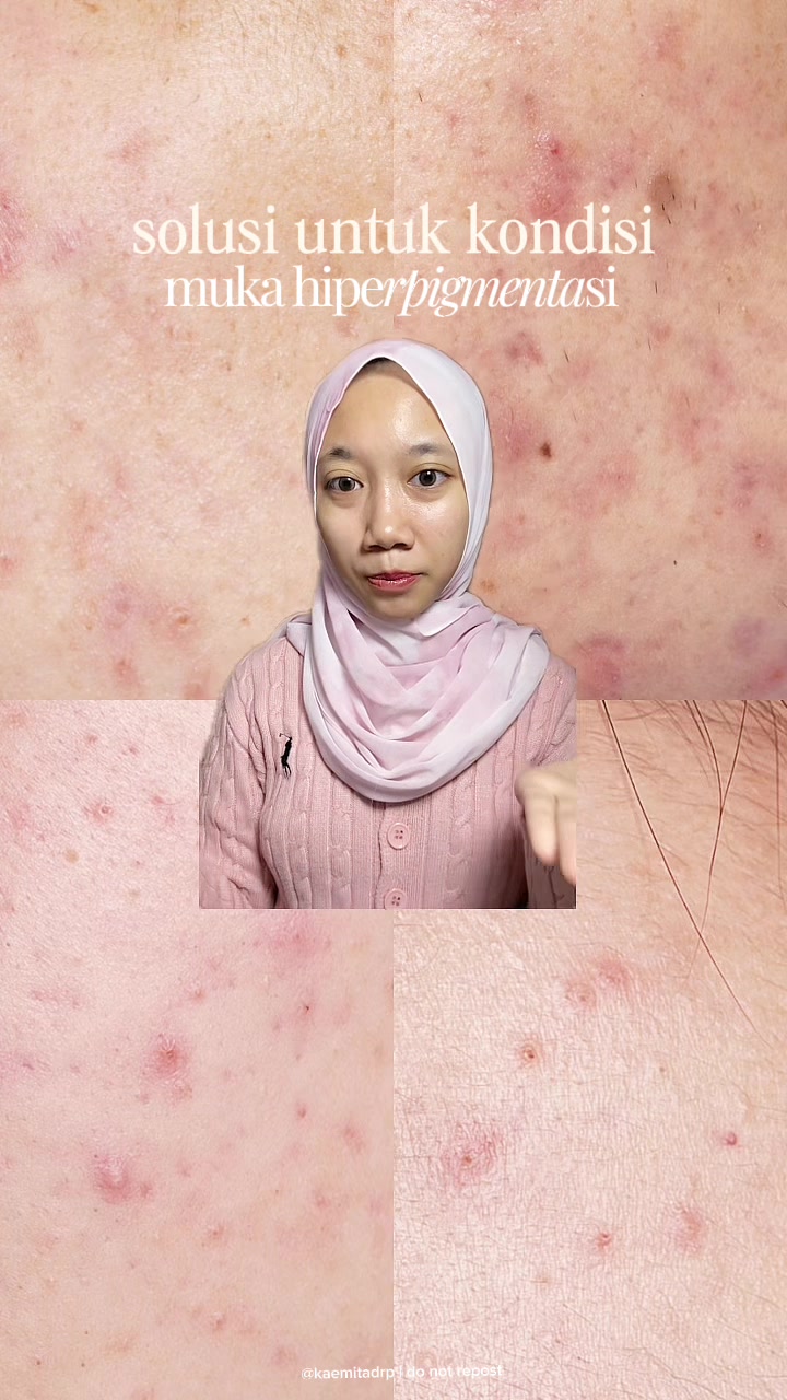 TikTok post by @kaemitadrpp for Laboré Sensitive Skin Expert. Caption reads: brightening set buat kalian yang alami....