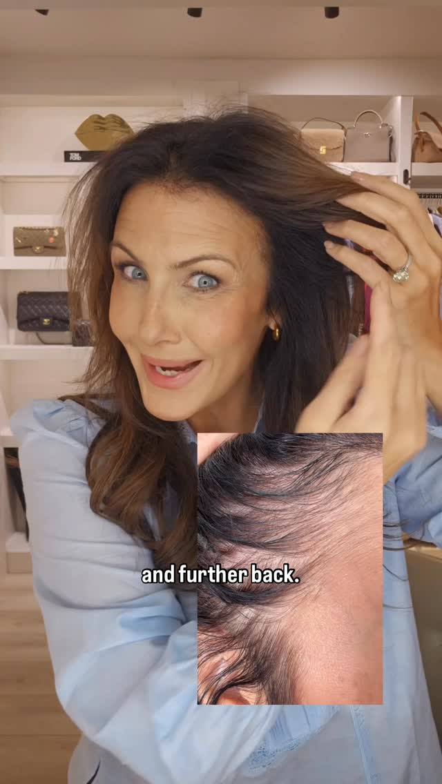 Instagram post by @scotstyleeditor for Chāmpo Haircare. Caption reads: If you’re starting to notice your hair shedding....