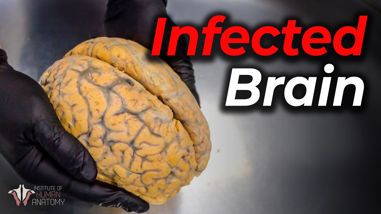 YouTube post by @theanatomylab for Brilliant.org. Caption reads: Rabies: One of the Most Deadly Viruses.