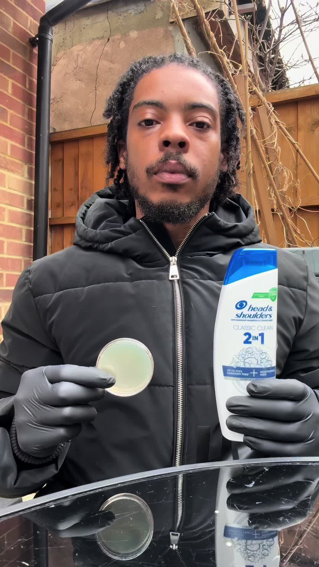 TikTok post by @big.manny1 for Head&Shoulders. Caption reads: #AD Dandruff is caused by the overgrowth of the....