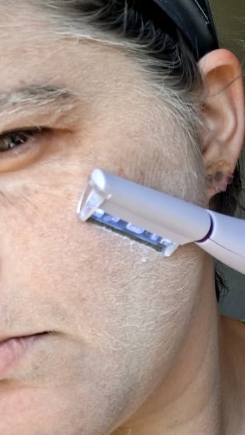 Instagram post by @aussiejakes for Michael Todd Beauty. Caption reads: #MichaelToddBeauty Gifted Me This Dermaplaning and....