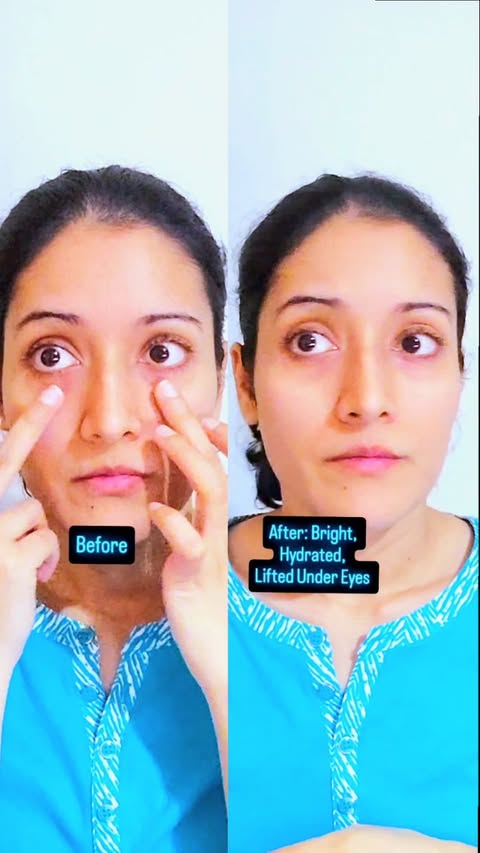 Instagram post by @nafixlove for Mizon. Caption reads: Say goodbye to tired eyes! These Mizon Hyaluronic....