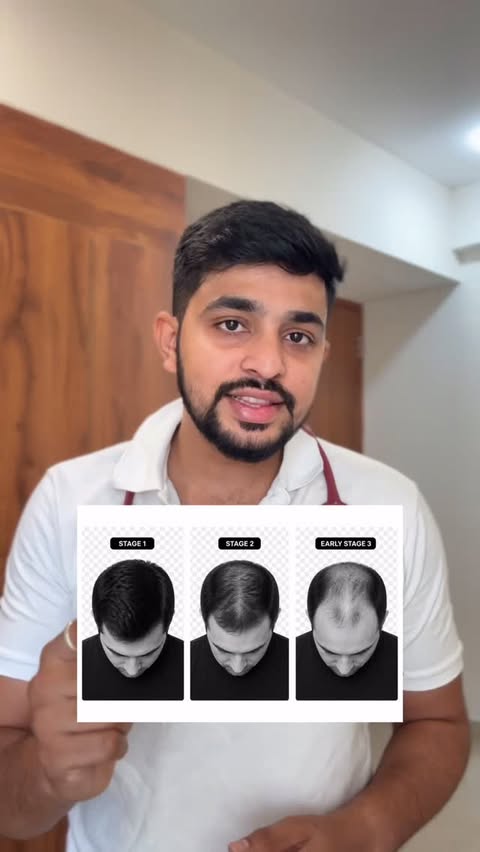 Instagram post by @dr_akash_bhairikoppa for Indulekha. Caption reads: [...] I got you covered. I came across Indulekha....