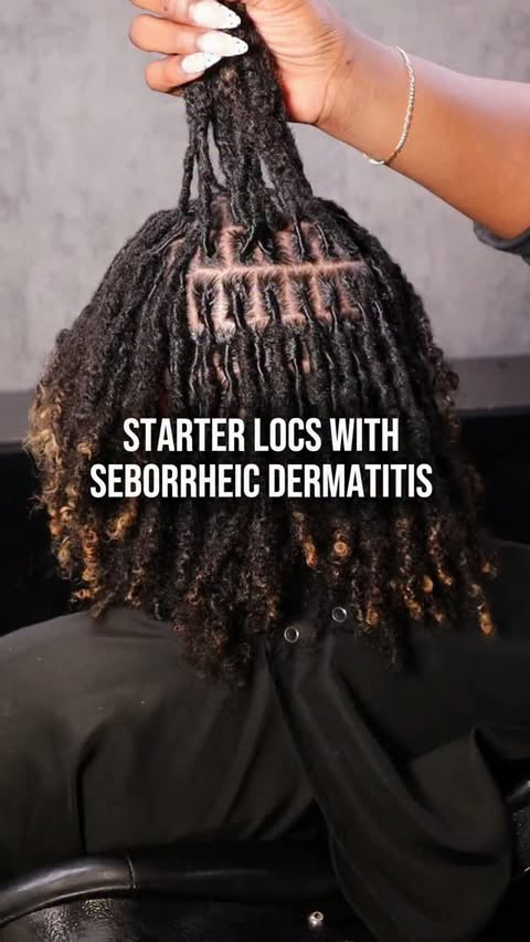 Instagram post by @caymoneistyles for CÉCRED. Caption reads: Starter locs with sebborheic dermatitis Use code:....