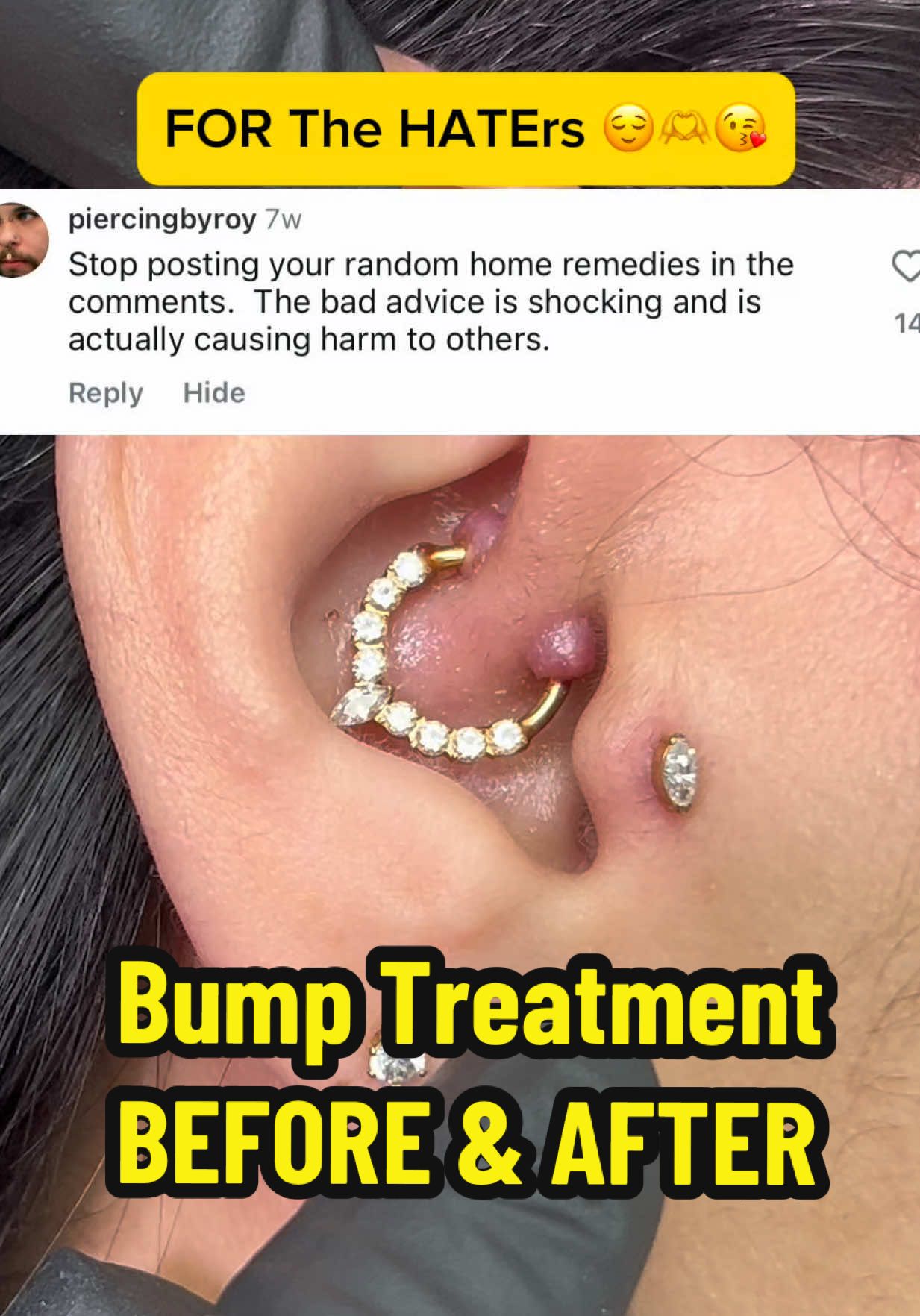 TikTok post by @anamarpiercing for Base Laboratories. Caption reads: Piercing bumps can require different approaches....